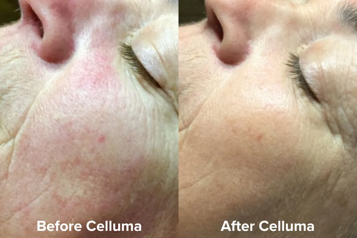 Celluma HOME