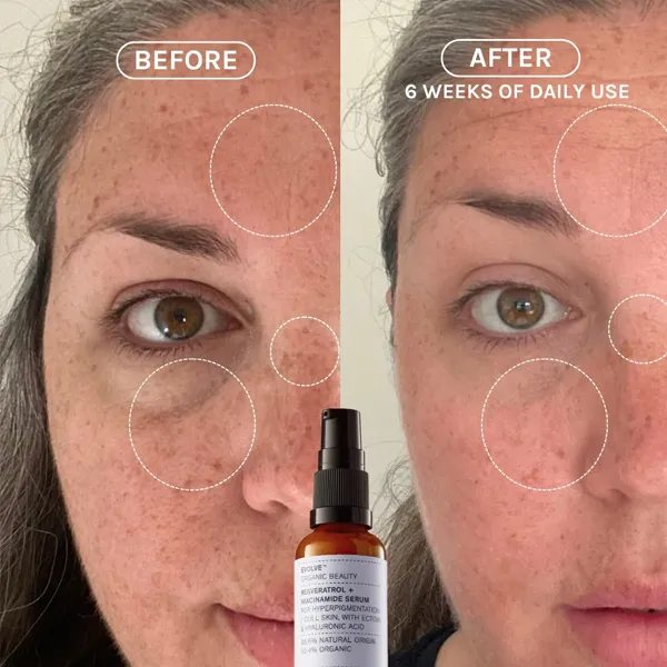 Resveratrol   Niacinamide Serum