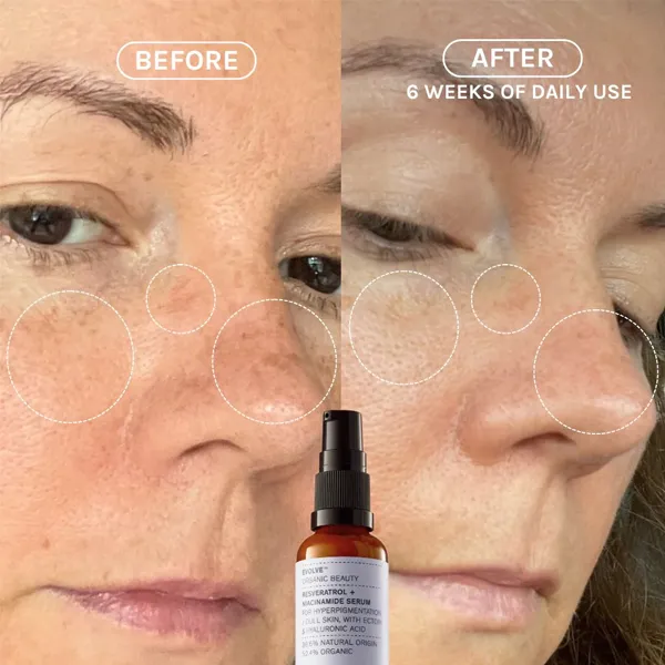 Resveratrol   Niacinamide Serum